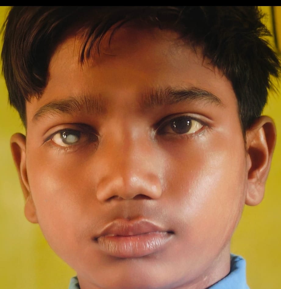 24 से 30 अक्टूबर तक चलाया जाएगा नेत्र सुरक्षा अभियान…